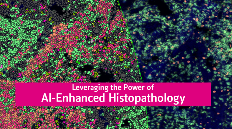 AI-Enhanced Histopathology in Immuno-oncology research